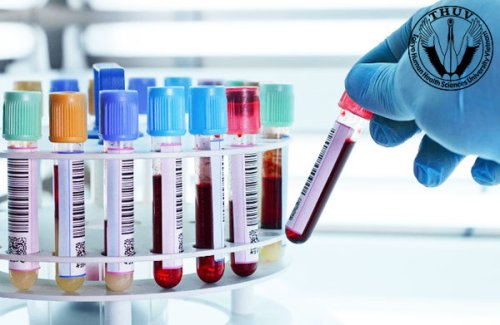 xet nghiẹm chan doan hinh anh1.jpg